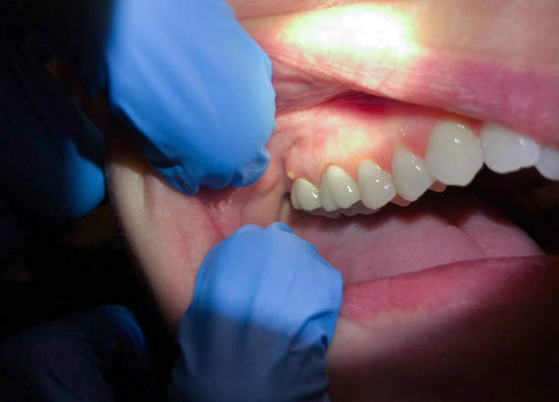 Best Urgent Care for Lost Fillings or Crowns in Hauser, ID