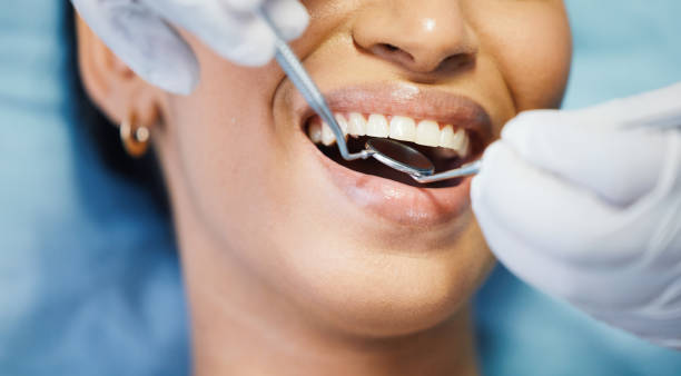 Best Emergency TMJ Treatment in Hauser, ID